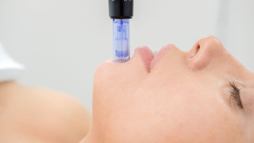 mesoterapia virtual