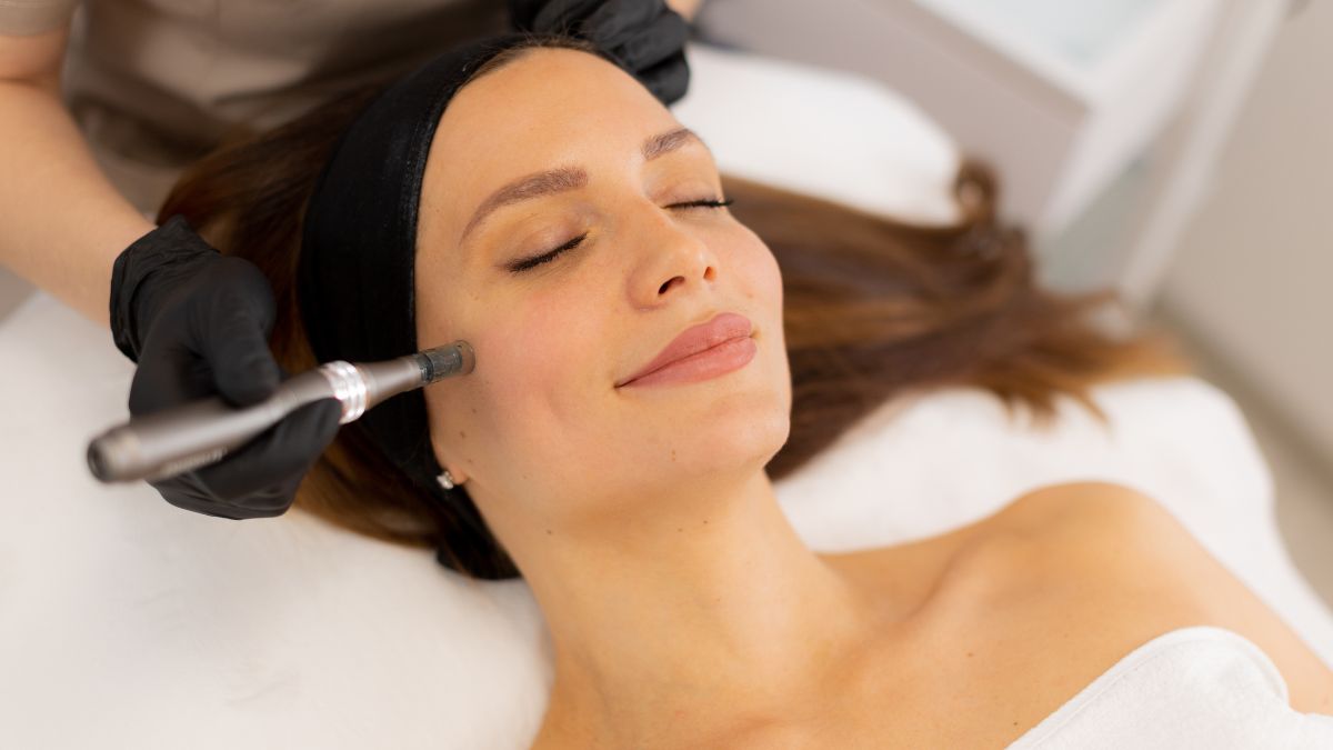 micrineedling facial