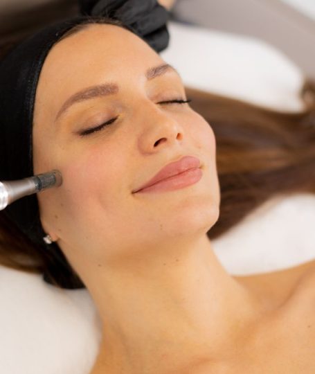 micrineedling facial
