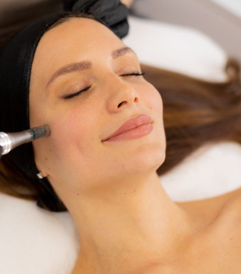 micrineedling facial